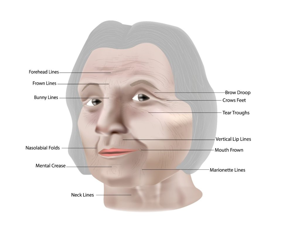 حقن الجل بتقنية MD Codes في الزعفرانية، لماذا تعطي هذه الطريقة نتيجة أطول؟